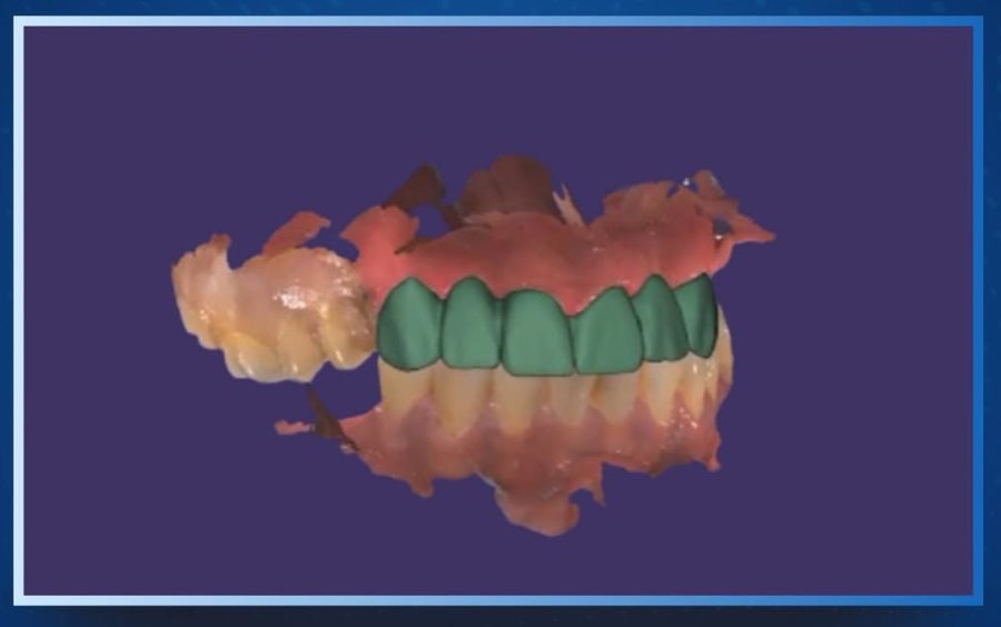 Diseño de Sonrisa